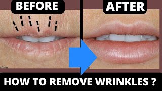 SMOKER LINES  FACE LIFTING EXERCISES FOR WRINKLES AROUND MOUTH  GET RID OF LIP LINES [upl. by Borer]