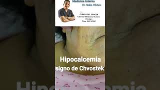 Hipocalcemia signo de Chvostek [upl. by Nihcas]