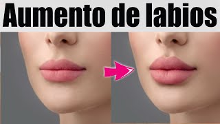 AUMENTO con ÁCIDO HIALURÓNICO 💋 BIOPLASTÍA de LABIOS 💄👄 ETERNA JUVENTUD ESTETIC CENTER [upl. by Forsyth94]