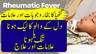 Rheumatic Fever Explained  Symptoms Complications and More rheumatic throatinfection heart [upl. by Lust]