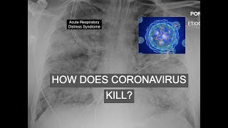 How Does Coronavirus Kill [upl. by Gusba]