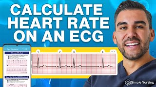 How to Calculate Heart Rate on ECG Easy Steps to Master Pulse Counting [upl. by Nedloh]