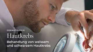 Behandlung von weissem und schwarzem Hautkrebs  Skinmed  Dermatologie und Ästhetische Medizin [upl. by Aronal538]