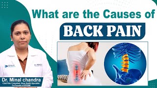 What are the Causes of Back Pain  Lower Back Pain Causes  Sciatica Causes  Epione [upl. by Alleiram]