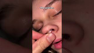 Insantly stops snoring🤯🤯 snoring snoreclips sleepapnea mouthbreathing snoringhusband [upl. by Gelya331]