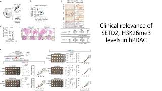 Clinical relevance of SETD2 H2K36me3 levels in hPDAC human pancreatic adenocarcinoma Code 736 [upl. by Pfosi]