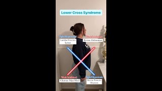 Upper and Lower Cross Syndrome [upl. by Sulrac527]