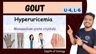 hyperuricemia and gout  gout Pathophysiology  gout nursing  gout  hyperuricemia gout sgsir [upl. by Avenej]