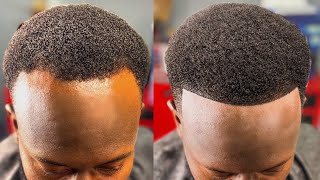 HOW TO FIX A BALDING RECEDING HAIRLINE  PERFECT HAIRCUT FIX [upl. by Hoskinson391]