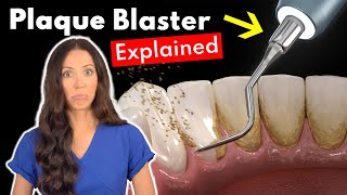 Dental Hygienist Explains Ultrasonic Scaling  Teeth Cleaning With Plaque Blaster [upl. by Auerbach]