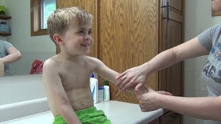 Mayo Clinic Minute Understanding childhood eczema [upl. by Jammie183]