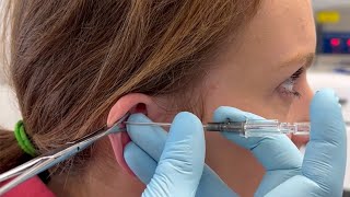 How to do Helix Piercing [upl. by Leay]