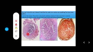 Histology Slides Series Episode 15  Histology of the Female Reproductive Organs and Mammary Gland [upl. by Mmada]