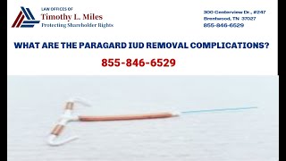 ParaGard IUD Removal Side Effects Lawsuit [upl. by Anire]