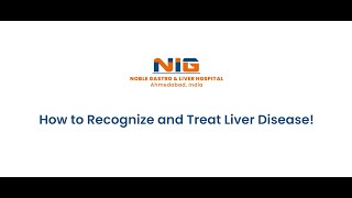 Understanding Liver Health Signs of Disease amp Essential Early Treatment Tips [upl. by Orag]