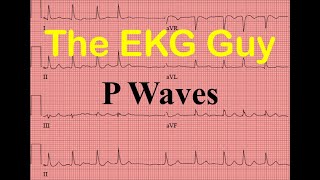 EKGECG P Waves  Question 40 l The EKG Guy [upl. by Lehacim924]