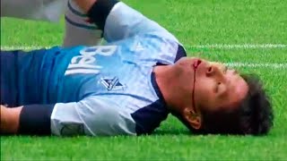 14 JOGADORES DE FUTEBOL QUE QUASE MORRERAM EM CAMPO [upl. by Enirahtac]