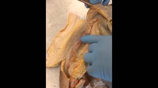 Urogenital system of female dogfish shark [upl. by Aes]