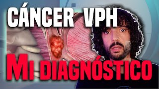 El VPH me causó Cáncer de garganta Así era el tumor que tenía [upl. by Anhpad]