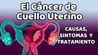 Así resisto al cáncer de seno y al mal sistema de salud  Jacqueline Ángeles [upl. by Chura397]