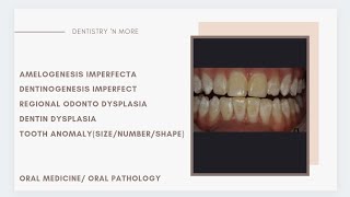 DEVELOPMENTAL ANOMALIES OF TEETH [upl. by Terri644]