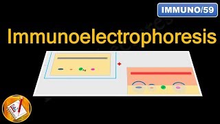 Immunoelectrophoresis FLImmuno59 [upl. by Nylauqcaj326]