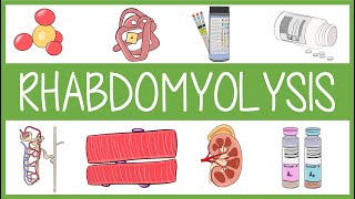 Rhabdomyolysis [upl. by Osmund547]