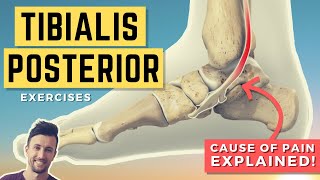 Tibialis Posterior Exercises Treat the Root Cause of Your Tib Post Pain PTTD [upl. by Lory]