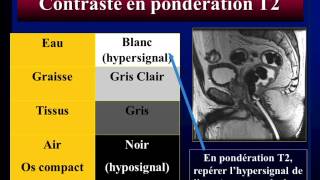 semiologie radiologique partie 6 [upl. by Peg728]