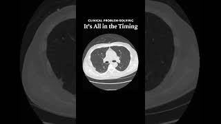 It’s All in the Timing Video 3  NEJM [upl. by Alys]