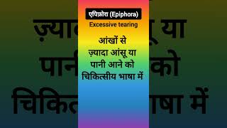 एपिफ़ोराEpiphoraExcessive tearingएपिफोरा का अर्थ क्या हैWhat is epiphora of the eye [upl. by Gardel797]