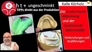 Von der anatomischen Abformung zum funktionellen Löffel [upl. by Illyes]