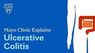 Mayo Clinic Explains Ulcerative Colitis [upl. by Eidnalem749]