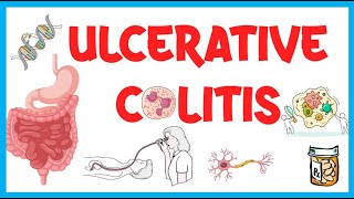 Ulcerative Colitis Causes Risk Factors Pathogenesis Clinical Presentation Diagnosis amp Treatment [upl. by Richelle]