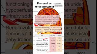 Prerenal vs renal azotemia [upl. by Limaj]