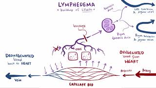 Lymphedema causes symptoms diagnosis treatment amp pathology [upl. by Melborn]