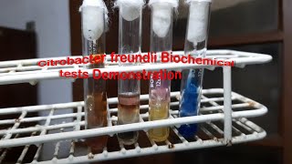 Citrobacter freundii Biochemical tests Demonstration [upl. by Ulyram128]