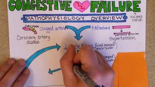 Congestive Heart Failure Pathophysiology [upl. by Nerat43]