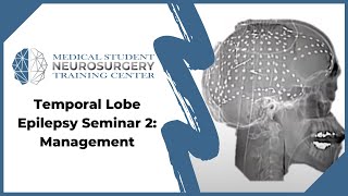 Temporal Lobe Epilepsy Seminar 2 Management [upl. by Juliano]