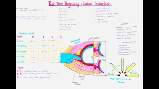 postterm pregnancy  labor induction [upl. by Sisak727]