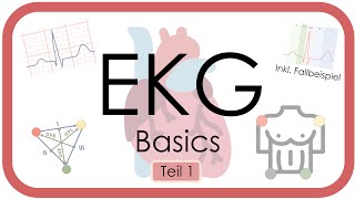 EKG Basics  Step by Step  Grundlagen Einthoven Frequenz Lagetyp PWelle QRS EKGKurs [upl. by Kurth]