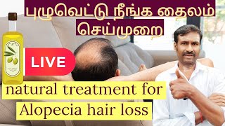 Natural treatment for Alopecia hair loss புழுவெட்டு நீங்க தைலம் [upl. by Alroy]