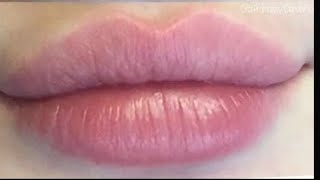 Heart shaped kisses ♡ lip filler procedure lip lift pink rosy color 💉 [upl. by Bella458]