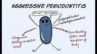 Aggressive Periodontitis Part 1  Etiology and Pathogenesis [upl. by Eladnar921]