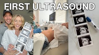 Our First Doctors Appointment amp Ultrasound  Pregnancy Vlog [upl. by Groeg449]