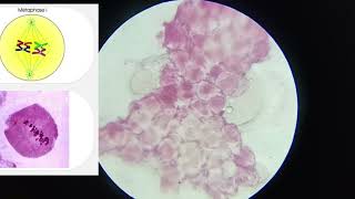 11th CLASS PRACTICAL  CELL DIVISION MEIOSIS 1 amp MEIOSIS 2  PROPHASE 5 STAGES  CBSE  GSEB bio [upl. by Areem566]