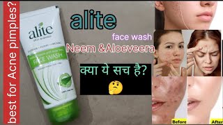 सिर्फ तीन दिन मे करे आपके pimple acne दूर क्या ये सच है alite Face wash for Acne pimples acne [upl. by Kenwee]