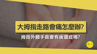 腳大拇指好痛怎麼辦？骨科醫師5分鐘帶你瞭解拇指外翻手術全過程【醫師在線等】 [upl. by Newbill]