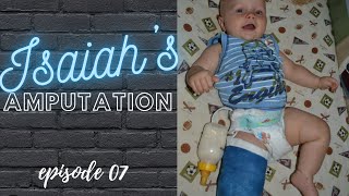 Isaiahs Amputation Story The Climb EP 07 [upl. by Bolme]