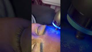 Microcurrent facial technology for a instant face lift ⚡️ [upl. by Ordep]